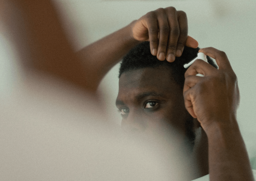 Does Minoxidil slow hair loss?